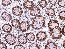 Invitrogen MRPL12 Polyclonal Antibody 100 μL; Unconjugated:Antibodies,