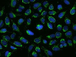 Invitrogen MRPS26 Polyclonal Antibody 100 &mu;L; Unconjugated:Antibodies,
