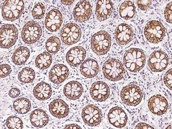 Invitrogen MRPS26 Polyclonal Antibody 100 &mu;L; Unconjugated:Antibodies,