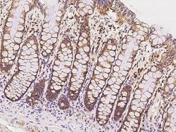 Invitrogen ICT1 Polyclonal Antibody 100 &mu;L; Unconjugated:Antibodies,