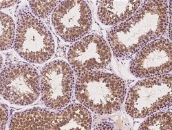 Invitrogen IFT81 Polyclonal Antibody 100 &mu;L | Buy Online | Invitrogen&trade; | Fisher Scientific