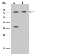 Invitrogen IFT81 Polyclonal Antibody 100 &mu;L | Buy Online | Invitrogen&trade; | Fisher Scientific