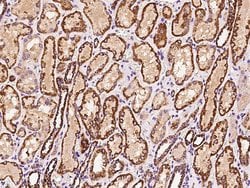 Invitrogen ATP5H Polyclonal Antibody 100 &mu;L; Unconjugated:Antibodies,