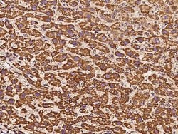 Invitrogen ATP5H Polyclonal Antibody 100 &mu;L; Unconjugated:Antibodies,