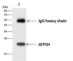 Invitrogen ATP5H Polyclonal Antibody 100 &mu;L; Unconjugated:Antibodies,