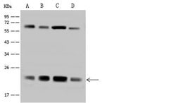 Invitrogen ATP5H Polyclonal Antibody 100 &mu;L; Unconjugated:Antibodies,