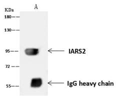 Invitrogen DDX21 Polyclonal Antibody 100 &mu;L; Unconjugated:Antibodies,