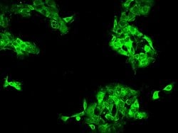 Invitrogen DYNC1LI1 Polyclonal Antibody 100 μL; Unconjugated:Antibodies,