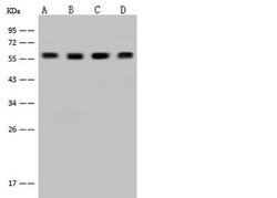 Invitrogen DYNC1LI1 Polyclonal Antibody 100 μL; Unconjugated:Antibodies,