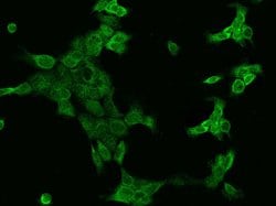 Invitrogen SSR3 Polyclonal Antibody 100 &mu;L; Unconjugated:Antibodies,