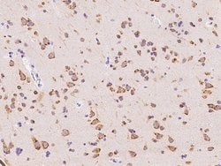 Invitrogen SSR3 Polyclonal Antibody 100 &mu;L; Unconjugated:Antibodies,
