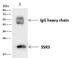 Invitrogen SSR3 Polyclonal Antibody 100 &mu;L; Unconjugated:Antibodies,