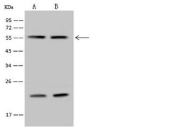 Invitrogen RBM34 Polyclonal Antibody 100 μL; Unconjugated:Antibodies,