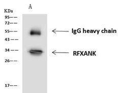 Invitrogen RFXANK Polyclonal Antibody 100 μL; Unconjugated:Antibodies,