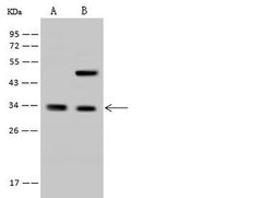 Invitrogen RFXANK Polyclonal Antibody 100 μL; Unconjugated:Antibodies,