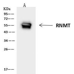Invitrogen RNMT Polyclonal Antibody 100 &mu;L; Unconjugated:Antibodies,