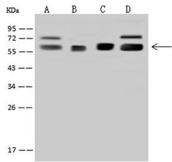 Invitrogen RNMT Polyclonal Antibody 100 &mu;L; Unconjugated:Antibodies,