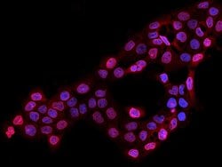 Invitrogen LAP2 Polyclonal Antibody 100 &mu;L; Unconjugated:Antibodies,