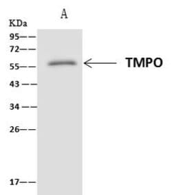 Invitrogen LAP2 Polyclonal Antibody 100 &mu;L; Unconjugated:Antibodies,