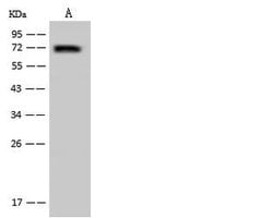 Invitrogen UTP18 Polyclonal Antibody 100 &mu;L | Buy Online | Invitrogen&trade; | Fisher Scientific