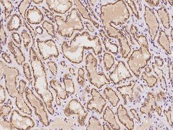Invitrogen YIPF4 Polyclonal Antibody 100 μL; Unconjugated:Antibodies,