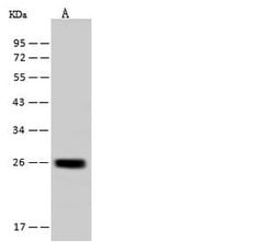 Invitrogen YIPF4 Polyclonal Antibody 100 μL; Unconjugated:Antibodies,