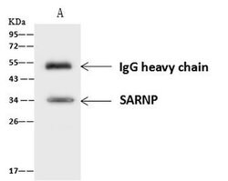 Invitrogen SARNP Polyclonal Antibody 100 &mu;L; Unconjugated:Antibodies,