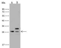 Invitrogen SPC24 Polyclonal Antibody 100 &mu;L; Unconjugated:Antibodies,