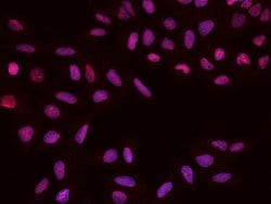 Invitrogen PAPSS1 Polyclonal Antibody 100 &mu;L; Unconjugated:Antibodies,