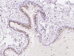 Invitrogen PAPSS1 Polyclonal Antibody 100 &mu;L; Unconjugated:Antibodies,
