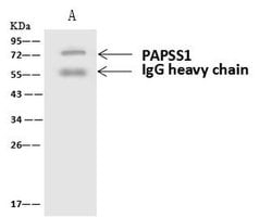 Invitrogen PAPSS1 Polyclonal Antibody 100 &mu;L; Unconjugated:Antibodies,