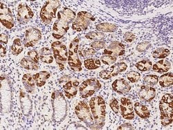 Invitrogen AUH Polyclonal Antibody 100 &mu;L; Unconjugated:Antikörper