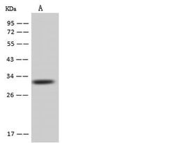 Invitrogen AUH Polyclonal Antibody 100 &mu;L; Unconjugated:Antikörper
