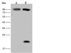 Invitrogen RAI16 Polyclonal Antibody 100 &mu;L; Unconjugated:Antibodies,