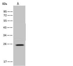 Invitrogen FA156 Polyclonal Antibody 100 μL; Unconjugated:Antibodies,