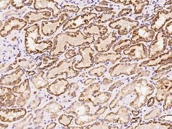 Invitrogen HSDL2 Polyclonal Antibody 100 μL; Unconjugated:Antibodies,