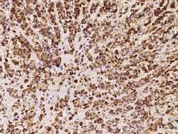 Invitrogen HSDL2 Polyclonal Antibody 100 μL; Unconjugated:Antibodies,