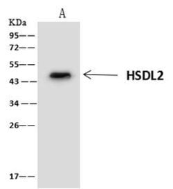 Invitrogen HSDL2 Polyclonal Antibody 100 μL; Unconjugated:Antibodies,
