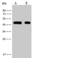 Invitrogen HSDL2 Polyclonal Antibody 100 μL; Unconjugated:Antibodies,
