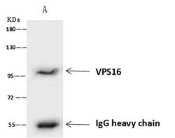 Invitrogen VPS16 Polyclonal Antibody 100 μL; Unconjugated:Antibodies,