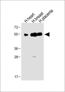 Invitrogen ENT1 Polyclonal Antibody 400 &mu;L | Buy Online | Invitrogen&trade; | Fisher Scientific