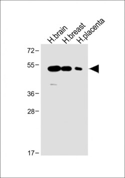 Invitrogen ENT1 Polyclonal Antibody 400 &mu;L | Buy Online | Invitrogen&trade; | Fisher Scientific