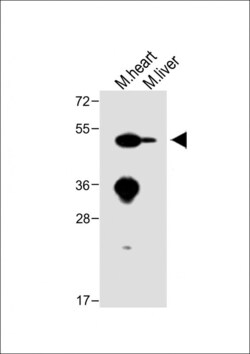 Invitrogen ENT1 Polyclonal Antibody 400 &mu;L | Buy Online | Invitrogen&trade; | Fisher Scientific