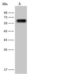 Invitrogen Golgi protein 58k Polyclonal Antibody 100 &mu;L; Unconjugated:Antikörper