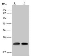 Invitrogen RWDD4 Polyclonal Antibody 100 &mu;L | Buy Online | Invitrogen&trade; | Fisher Scientific