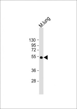 Invitrogen ENT1 Polyclonal Antibody 200 &mu;L; Unconjugated:Antibodies,