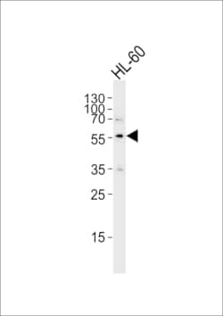 Invitrogen ENT1 Polyclonal Antibody 200 &mu;L; Unconjugated:Antibodies,
