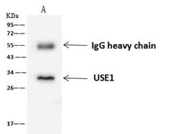 Invitrogen USE1 Polyclonal Antibody 100 &mu;L; Unconjugated:Antibodies,