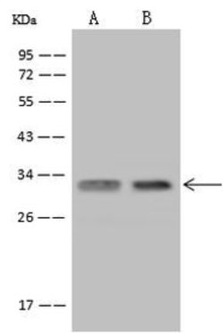 Invitrogen USE1 Polyclonal Antibody 100 &mu;L; Unconjugated:Antibodies,