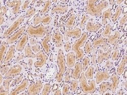 Invitrogen GLRB Polyclonal Antibody 100 μL; Unconjugated:Antibodies,